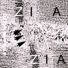 Z disc and intermediate filaments